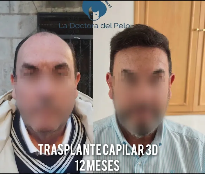 LA DOCTORA DEL PELO